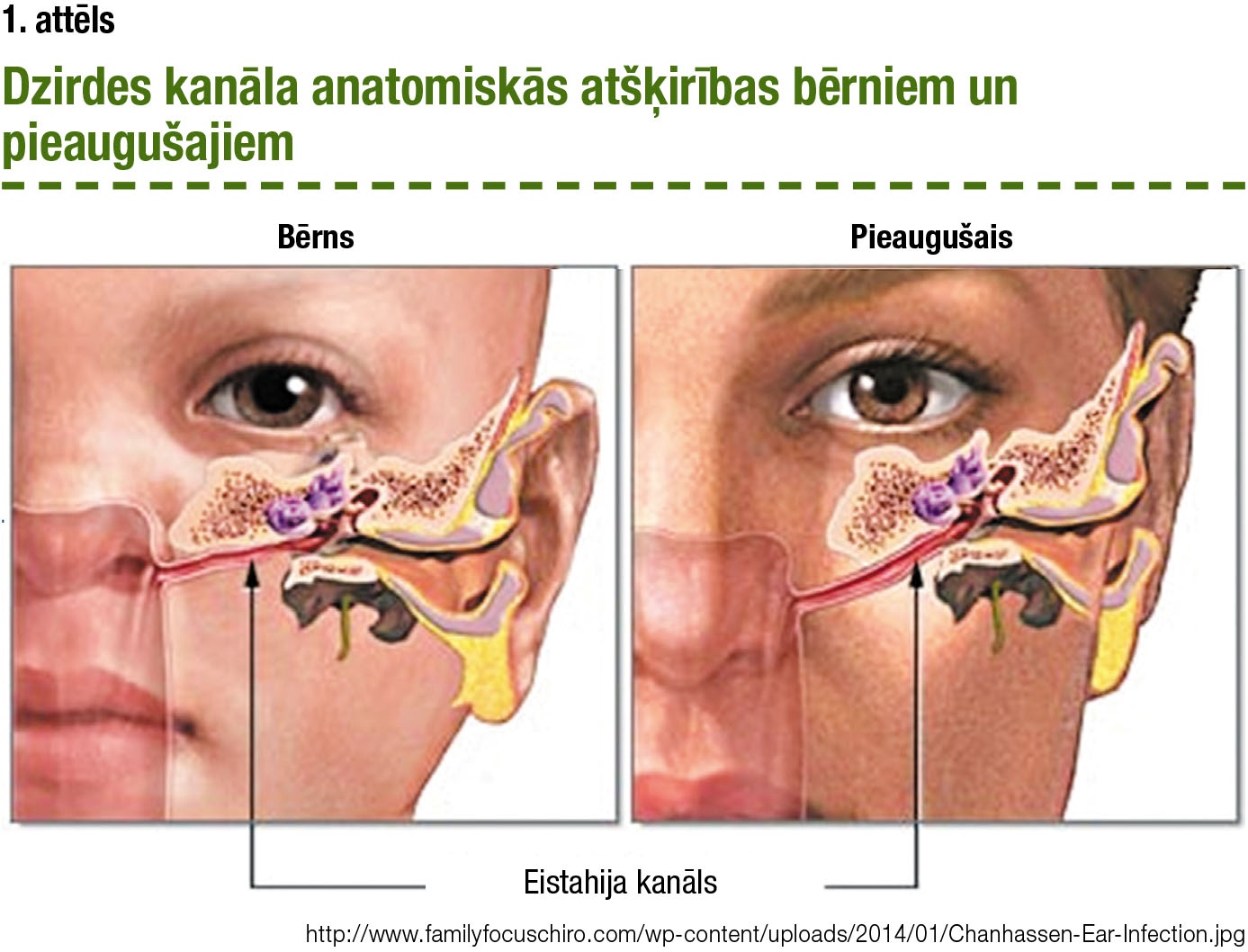 Dzirdes kanāla anatomiskās atšķirības bērniem un pieaugušajiem