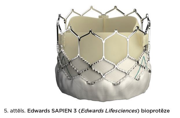 Edwards SAPIEN 3 bioprotēze