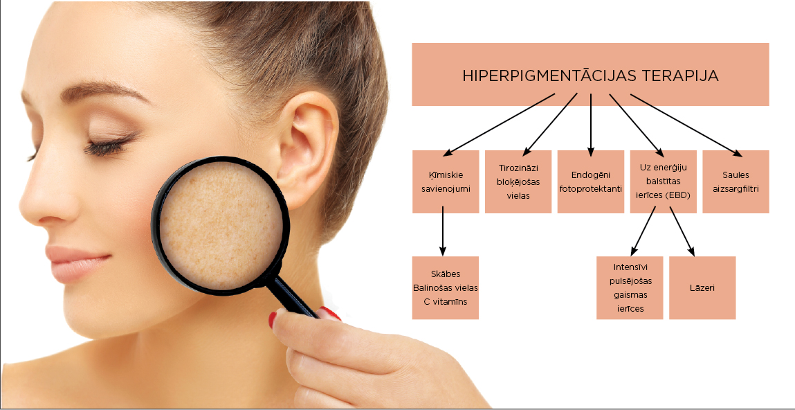 Hiperpigmentācijas terapija