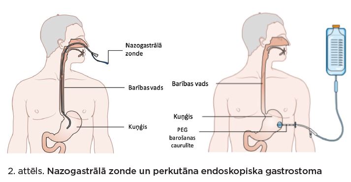 zonde