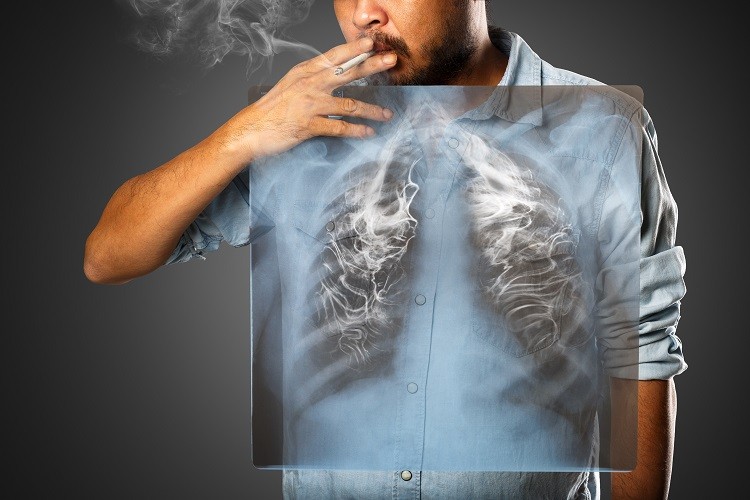 Rihards Mikilps-Mikgelbs: Plaušu vēzis