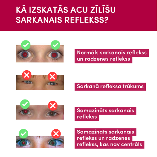 acu sarkanā refleksa tests