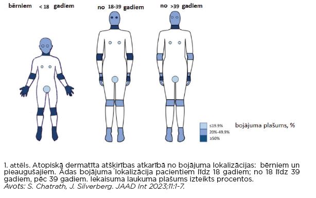  1.attēls. Atopiskā dermatīta atšķirības atkarībā no bojājuma lokalizācijas:  bērniem un pieaugušiem.