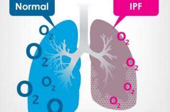 IPF infografika