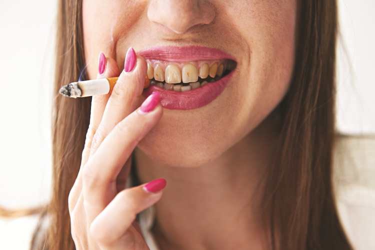 Darja Ķīse: Smēķēšana un zobu veselība